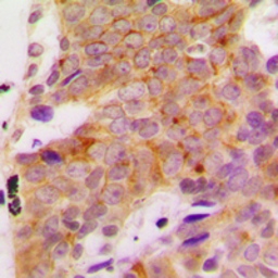Anti-p70 S6K (phospho Ser418) antibody used in IHC (Paraffin sections) (IHC-P). GTX32258
