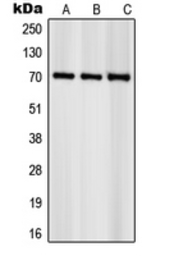Anti-p70 S6K (phospho Ser418) antibody used in Western Blot (WB). GTX32258