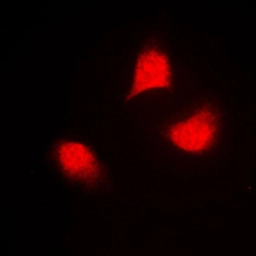 Anti-SEK1 / MKK4 (phospho Thr261) antibody used in Immunocytochemistry/ Immunofluorescence (ICC/IF). GTX32260
