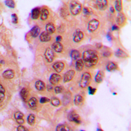Anti-SEK1 / MKK4 (phospho Thr261) antibody used in IHC (Paraffin sections) (IHC-P). GTX32260