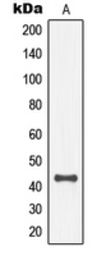 Anti-SEK1 / MKK4 (phospho Thr261) antibody used in Western Blot (WB). GTX32260