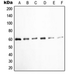 Anti-Src (phospho Tyr530) antibody used in Western Blot (WB). GTX32265