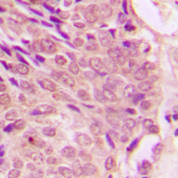 Anti-STAT1 (phospho Ser727) antibody used in IHC (Paraffin sections) (IHC-P). GTX32266