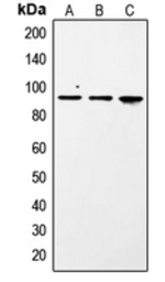 Anti-STAT1 (phospho Ser727) antibody used in Western Blot (WB). GTX32266