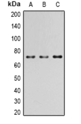 Anti-PAK4 (phospho Ser474) / PAK5 (phospho Ser602) / PAK6 (phospho Ser560) antibody used in Western Blot (WB). GTX32289