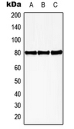 Anti-HBP1 (phospho Ser402) antibody used in Western Blot (WB). GTX32290