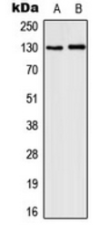 Anti-IL3 Receptor beta (phospho Tyr593) antibody used in Western Blot (WB). GTX32320