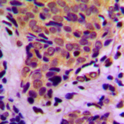 Anti-4E-BP1 (phospho Thr37) antibody used in IHC (Paraffin sections) (IHC-P). GTX32322