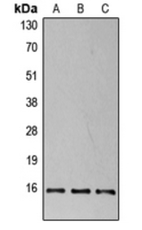 Anti-4E-BP1 (phospho Thr37) antibody used in Western Blot (WB). GTX32322