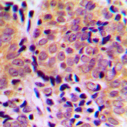 Anti-4E-BP1 (phospho Thr46) antibody used in IHC (Paraffin sections) (IHC-P). GTX32323