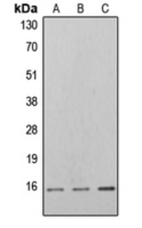 Anti-4E-BP1 (phospho Thr46) antibody used in Western Blot (WB). GTX32323