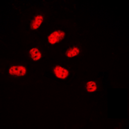 Anti-ELK3 (phospho Ser357) antibody used in Immunocytochemistry/ Immunofluorescence (ICC/IF). GTX32324