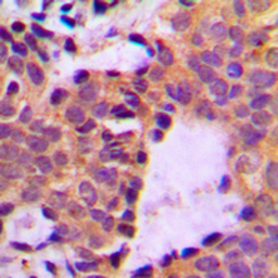 Anti-Cortactin (phospho Tyr466) antibody used in IHC (Paraffin sections) (IHC-P). GTX32326