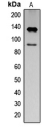 Anti-IFNAR1 (phospho Tyr466) antibody used in Western Blot (WB). GTX32330