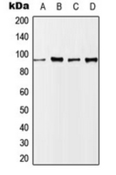 Anti-NBS1 (phospho Ser343) antibody used in Western Blot (WB). GTX32339