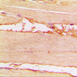 Anti-Merlin (phospho Ser518) antibody used in IHC (Paraffin sections) (IHC-P). GTX32340