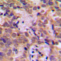Anti-NFkB p105 (phospho Ser932) antibody used in IHC (Paraffin sections) (IHC-P). GTX32341