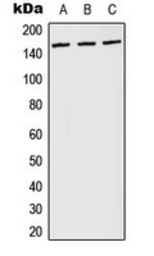 Anti-PLCG1 (phospho Tyr783) antibody used in Western Blot (WB). GTX32343