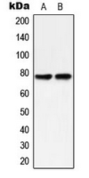 Anti-PKC delta (phospho Tyr313) antibody used in Western Blot (WB). GTX32346