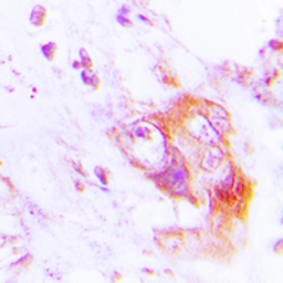 Anti-PKR (phospho Thr451) antibody used in IHC (Paraffin sections) (IHC-P). GTX32348