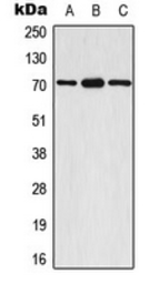 Anti-p70 S6K (phospho Ser447) antibody used in Western Blot (WB). GTX32354
