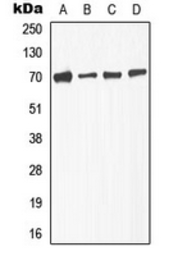 Anti-TGF beta Receptor 2 (phospho Ser225) antibody used in Western Blot (WB). GTX32359