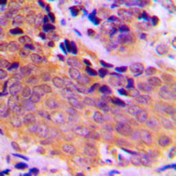 Anti-VASP (phospho Ser157) antibody used in IHC (Paraffin sections) (IHC-P). GTX32362