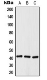 Anti-HDAC8 (phospho Ser39) antibody used in Western Blot (WB). GTX32364