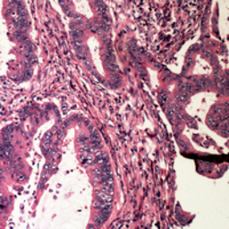 Anti-Bad (phospho Ser112) antibody used in IHC (Paraffin sections) (IHC-P). GTX32370