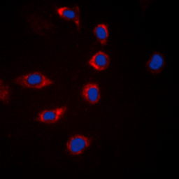 Anti-Bad (phospho Ser155) antibody used in Immunocytochemistry/ Immunofluorescence (ICC/IF). GTX32371