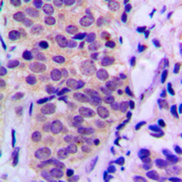 Anti-Bad (phospho Ser155) antibody used in IHC (Paraffin sections) (IHC-P). GTX32371