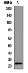 Anti-Bad (phospho Ser155) antibody used in Western Blot (WB). GTX32371