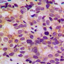 Anti-Bcl-2 (phospho Ser87) antibody used in IHC (Paraffin sections) (IHC-P). GTX32372