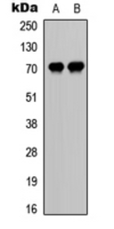 Anti-CDC25A (phospho Ser76) antibody used in Western Blot (WB). GTX32374
