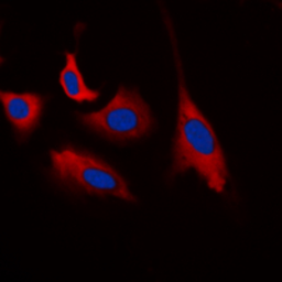 Anti-CDK5 (phospho Tyr15) antibody used in Immunocytochemistry/ Immunofluorescence (ICC/IF). GTX32375