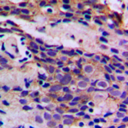 Anti-CDK5 (phospho Tyr15) antibody used in IHC (Paraffin sections) (IHC-P). GTX32375