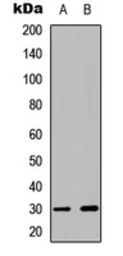 Anti-CDK5 (phospho Tyr15) antibody used in Western Blot (WB). GTX32375