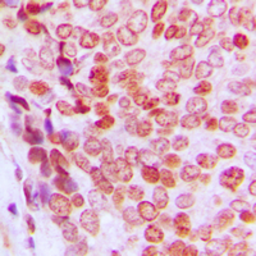 Anti-p21 Cip1 (phospho Thr145) antibody used in IHC (Paraffin sections) (IHC-P). GTX32376