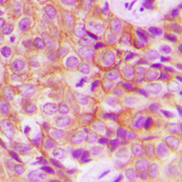 Anti-EGFR (phospho Thr669) antibody used in IHC (Paraffin sections) (IHC-P). GTX32385