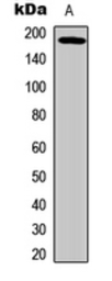 Anti-EGFR (phospho Thr669) antibody used in Western Blot (WB). GTX32385