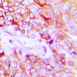 Anti-Her4 / ErbB4 (phospho Tyr1284) antibody used in IHC (Paraffin sections) (IHC-P). GTX32389