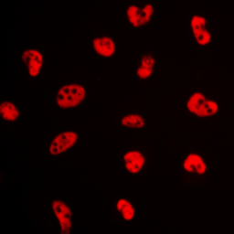 Anti-Estrogen Receptor alpha (phospho Ser106) antibody used in Immunocytochemistry/ Immunofluorescence (ICC/IF). GTX32390