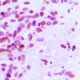 Anti-Estrogen Receptor alpha (phospho Ser106) antibody used in IHC (Paraffin sections) (IHC-P). GTX32390