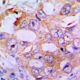Anti-IRS1 (phospho Ser636) antibody used in IHC (Paraffin sections) (IHC-P). GTX32400