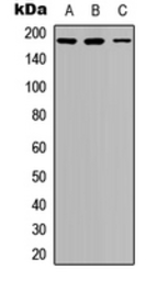 Anti-IRS1 (phospho Ser636) antibody used in Western Blot (WB). GTX32400