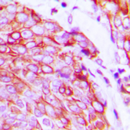 Anti-VEGF Receptor 2 (phospho Tyr1175) antibody used in IHC (Paraffin sections) (IHC-P). GTX32403