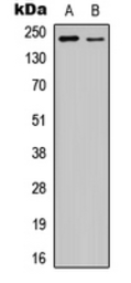 Anti-VEGF Receptor 2 (phospho Tyr1175) antibody used in Western Blot (WB). GTX32403