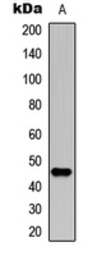 Anti-NCF1 (phospho Ser304) antibody used in Western Blot (WB). GTX32406
