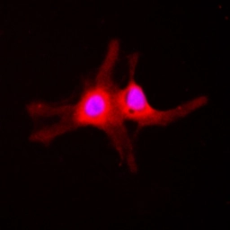 Anti-SGK1 (phospho Ser422) antibody used in Immunocytochemistry/ Immunofluorescence (ICC/IF). GTX32413
