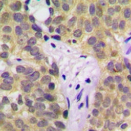 Anti-SGK1 (phospho Ser422) antibody used in IHC (Paraffin sections) (IHC-P). GTX32413